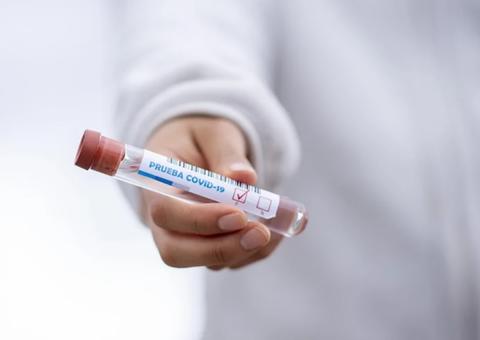 Amazonas ultrapassa 27 mil infectados pela Covid-19 