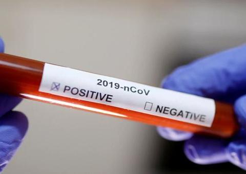 Empresa no Amazonas tem atividades paralisadas após ter quase 100 funcionários com coronavírus