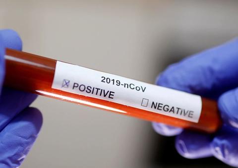 Interior do Amazonas chega a 18.708 casos confirmados de Covid-19