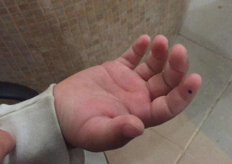 Com sinais de espancamento, criança morre em SPA de Manaus