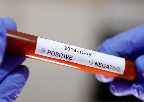 Brasil ultrapassa França e se torna o 4º país com mais mortes por coronavírus