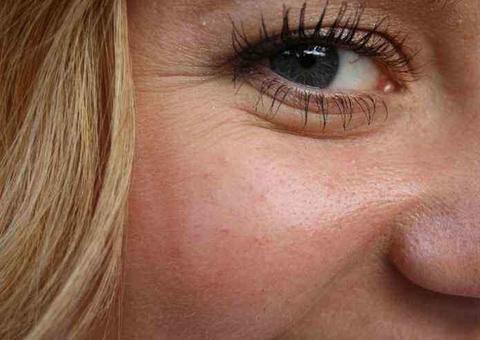 Conheça 5 hábitos que colaboram para o envelhecimento da pele