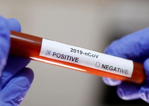 Brasil ultrapassa meio milhão de casos de Covid-19