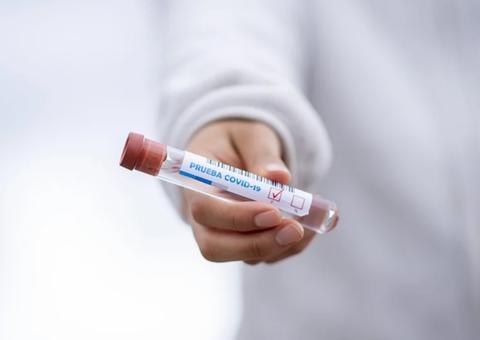 Interior do Amazonas chega a 15.178 infectados e 686 mortos pela Covid-19 