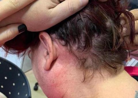 Médica é agredida por marido de grávida em trabalho de parto