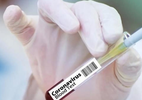 Pesquisadores anunciam que 10 vacinas contra coronavírus entram em fase de testes em humanos
