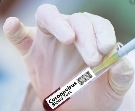 Pesquisadores anunciam que 10 vacinas contra coronavírus entram em fase de testes em humanos