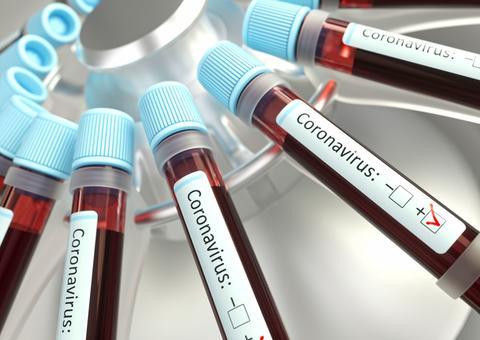 Veja quais são os dados sobre coronavírus que governo vem retirando de divulgações