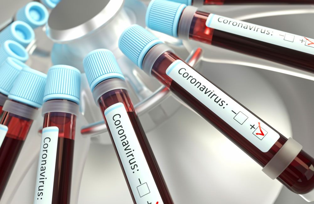 Veja quais são os dados sobre coronavírus que governo vem retirando de divulgações