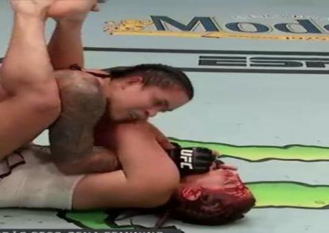 Brasileira Amanda Nunes deixa rosto de lutadora rival deformado; veja