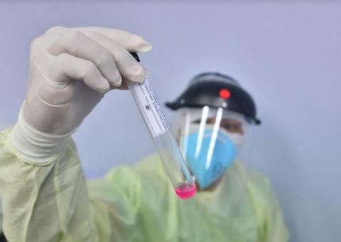 Amazonas chega a 49.269 casos confirmados de coronavírus