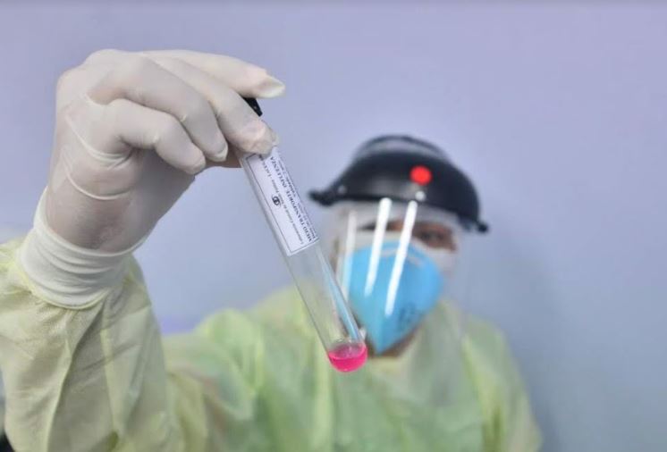 Amazonas chega a 49.269 casos confirmados de coronavírus