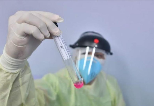 Casos de coronavírus no Amazonas sobem para 49.817; óbitos somam 2.271