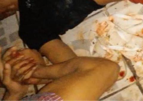 Jovem tem mão decepada ao desobedecer ordem de criminosos no Amazonas 