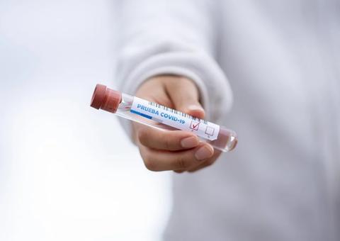 Com 1.122 novos casos, Amazonas salta para 55 mil infectados pelo novo coronavírus  