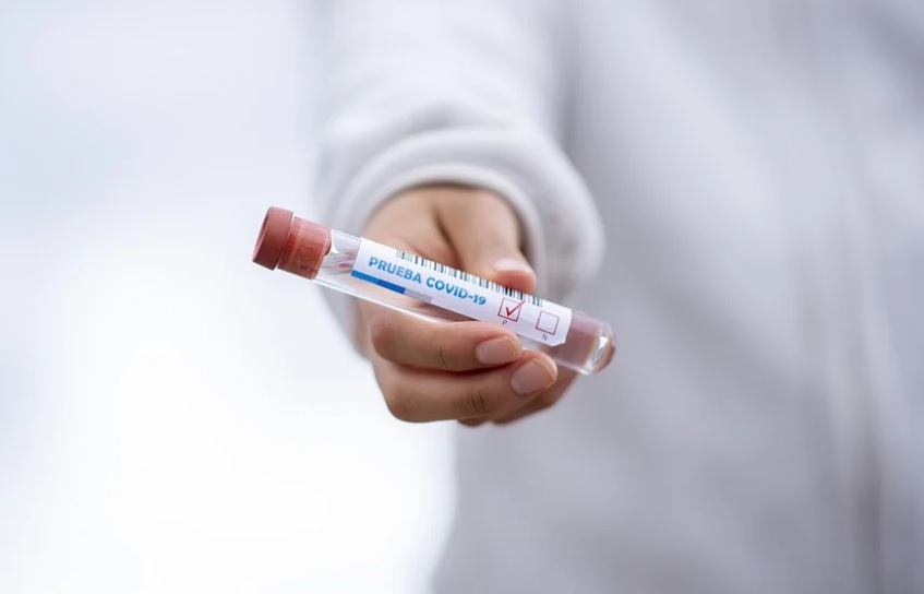 Com 1.122 novos casos, Amazonas salta para 55 mil infectados pelo novo coronavírus  