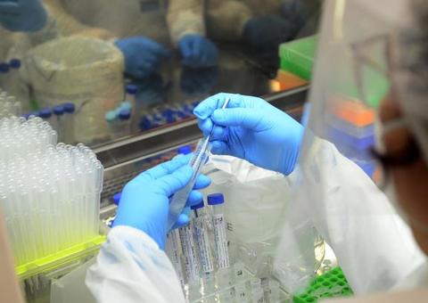 Planos de saúde devem custear testes e exames da Covid-19 no Amazonas, diz MP