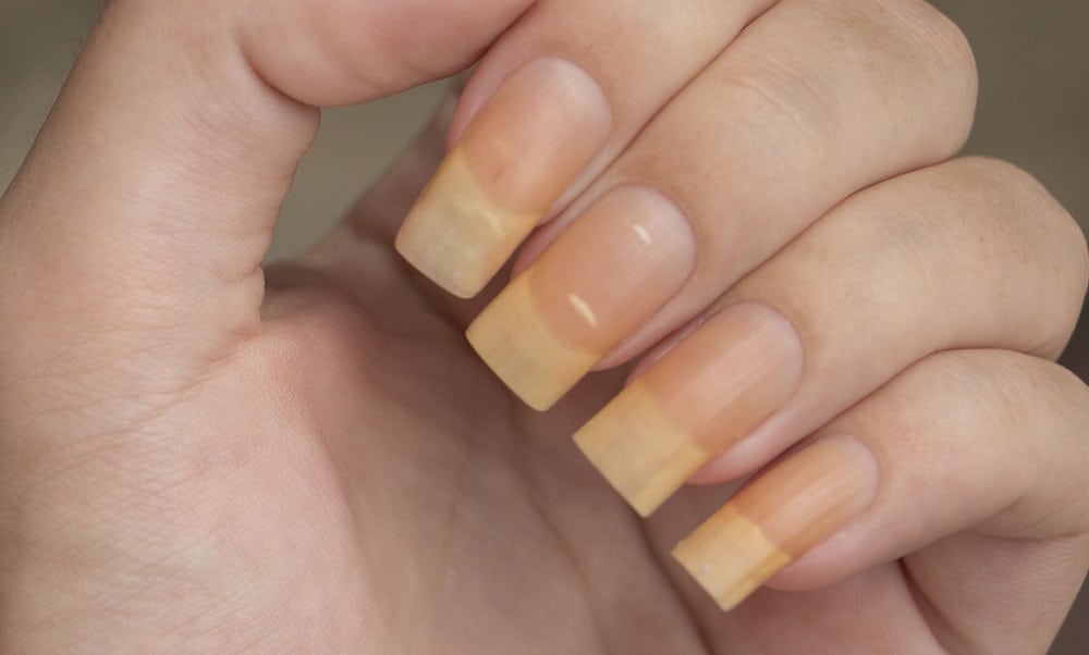 Veja quais motivos que podem deixar suas unhas amarelas