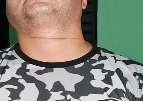 Cabo da PM é ferido ao ser atingido por linha de papagaio com cerol em Manaus 