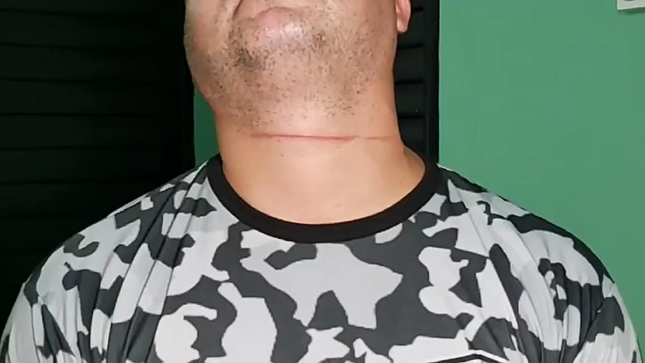 Cabo da PM é ferido ao ser atingido por linha de papagaio com cerol em Manaus 