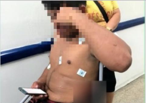 Suspeito de cometer assalto atira contra policiais e leva a pior em Manaus