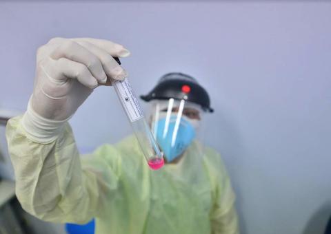 Ipixuna registra primeiros casos de covid-19; interior soma 38. 578 infectados