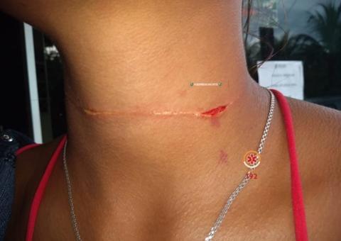 Mulher tem pescoço cortado ao ficar presa em linha de cerol no Amazonas