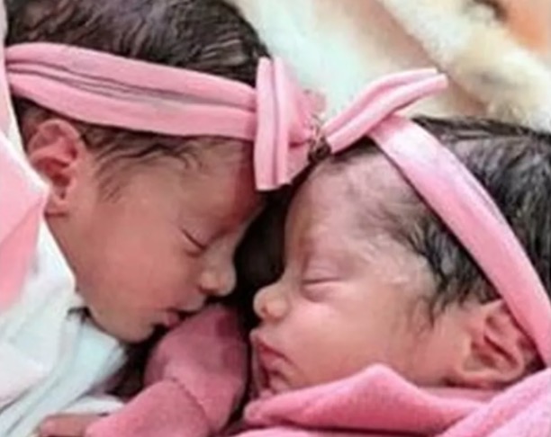 Cachorro ataca e mata gêmeas recém-nascidas dentro de casa