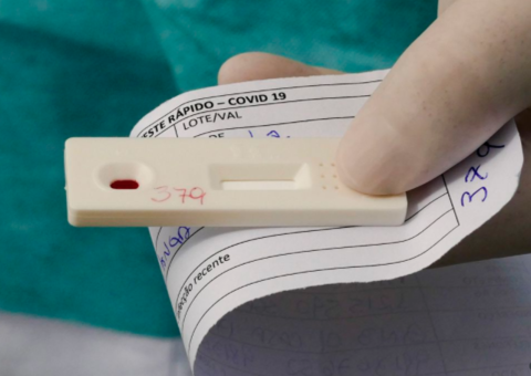 Ministério anuncia novos critérios para caracterizar casos de covid-19