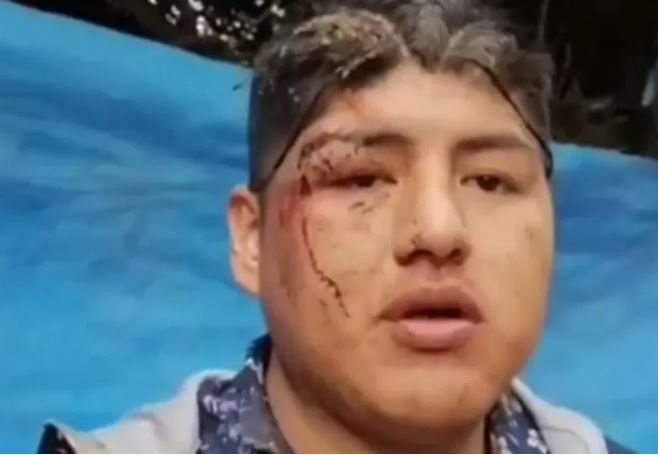 Homem acorda dentro de caixão após ser oferecido em ritual