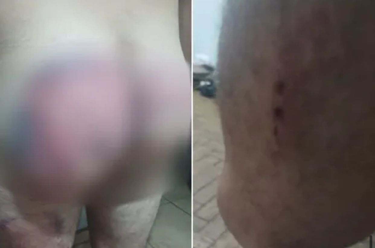 Exército expulsa seis militares envolvidos em agressão a soldado no quartel