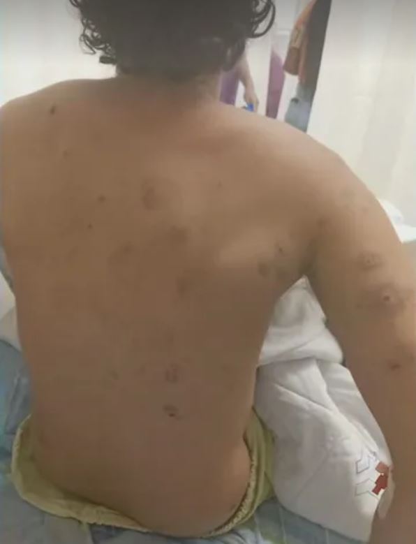 Brasileiro fica ferido e outros dois desaparecem durante ataque a Israel