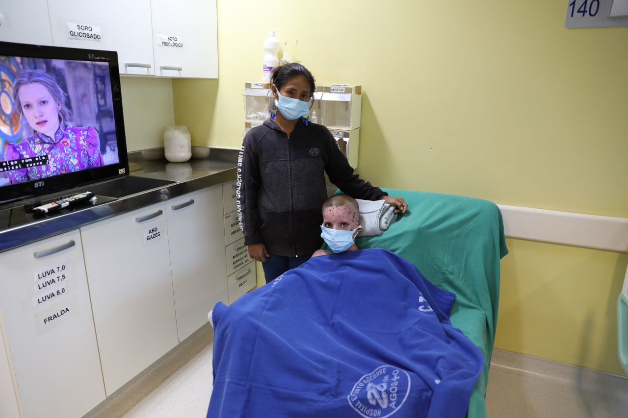 Adolescente que teve mais da metade do corpo queimado pega alta em Manaus