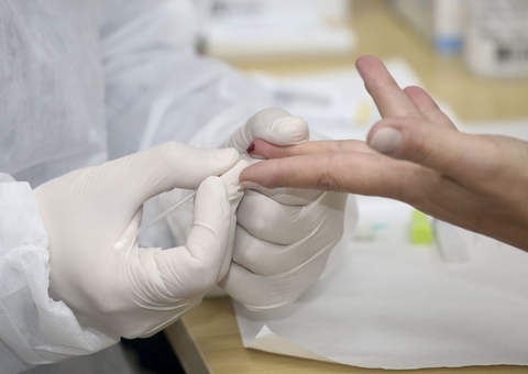 Amazonas registrou 2.151 novos infectados nas últimas 24 horas