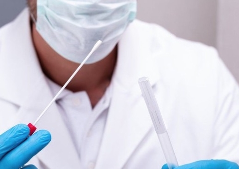 Mais de 800 pessoas no Amazonas testaram positivo para Covid nesta sexta