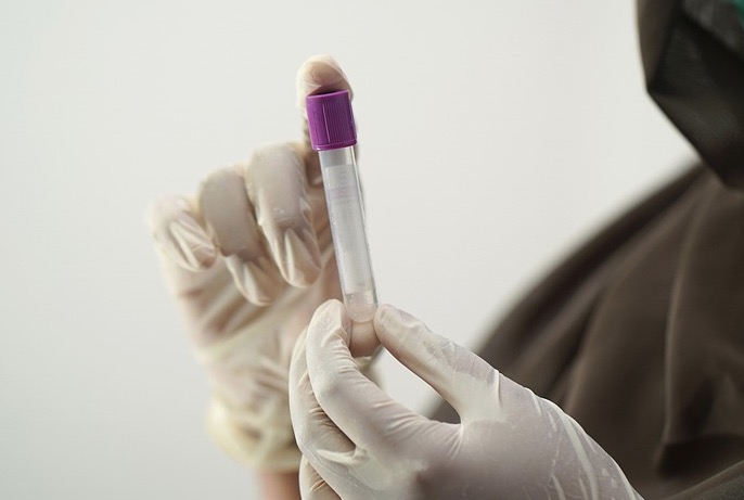 Mais de 800 pessoas no Amazonas testaram positivo para Covid nesta sexta