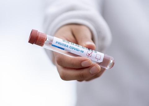 Amazonas registra 556 novos casos de Covid-19