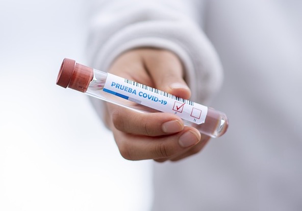 Amazonas registra 556 novos casos de Covid-19