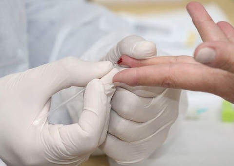 Amazonas registra 821 novos casos de Covid-19 em apenas um dia