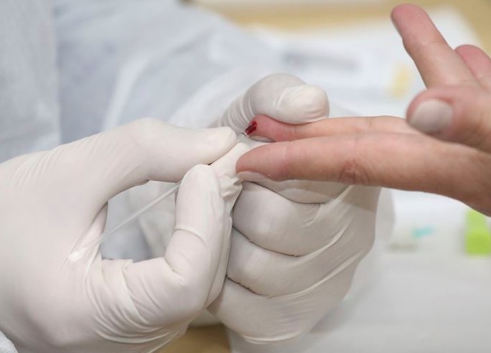 Amazonas registra 821 novos casos de Covid-19 em apenas um dia