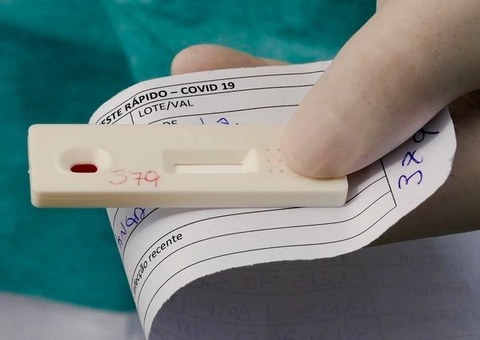 Amazonas registra 1.156 novos casos de Covid em apenas 1 dia