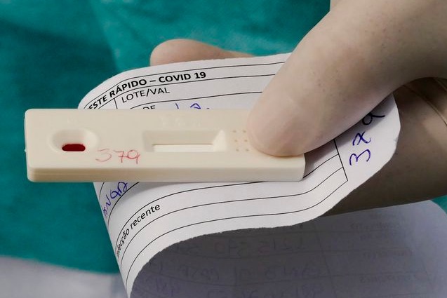 Amazonas registra 1.156 novos casos de Covid em apenas 1 dia