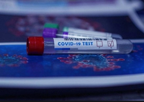 Amazonas registra 351 novos casos de Covid nas últimas 24 horas