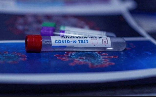 Amazonas registra 351 novos casos de Covid nas últimas 24 horas