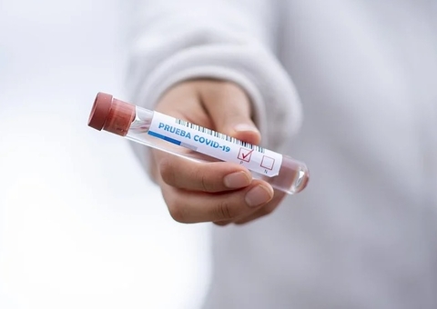 Governador do Pará diz que casos de Covid no estado tem relação com o AM 