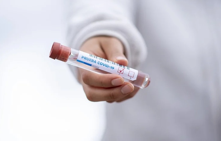 Governador do Pará diz que casos de Covid no estado tem relação com o AM 