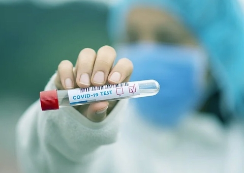 Amazonas registra 418 novos casos de Covid-19 em 24 horas