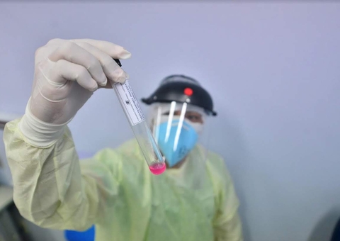 Amazonas ultrapassa 162 mil casos de covid-19