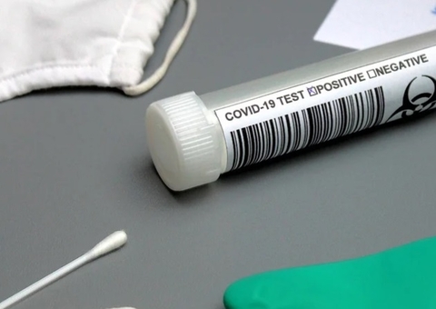 Amazonas tem 719 novos casos de Covid, confirma FVS