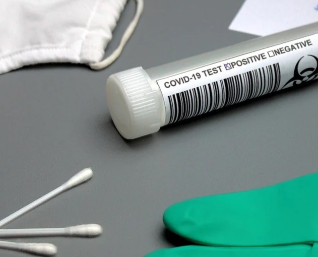 Amazonas tem 719 novos casos de Covid, confirma FVS